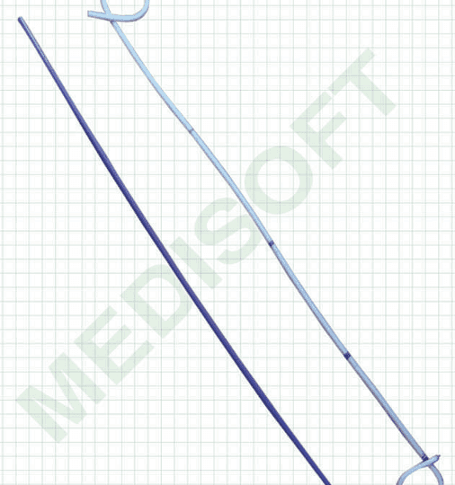 Uteral Stents