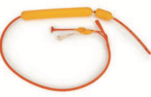 Esophageal Sengstaken Tube