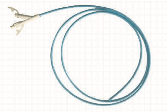 Jejunal Feeding Tube